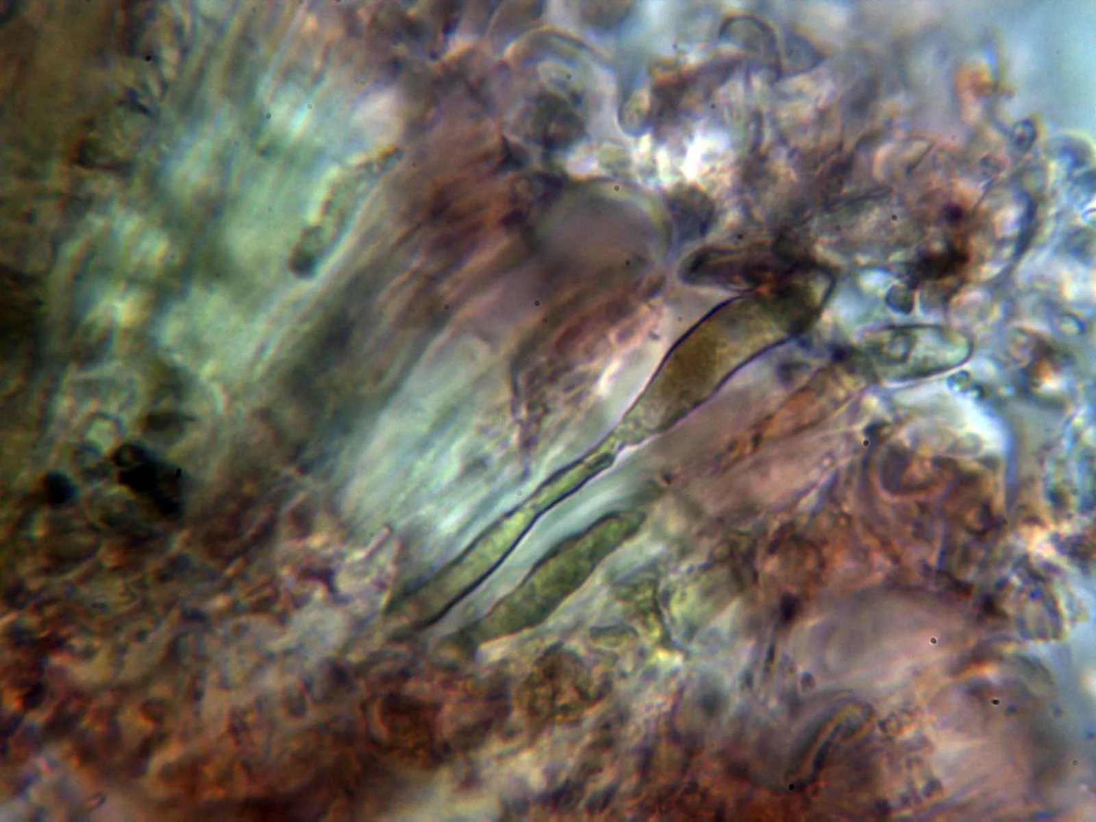 Microscopía de Lecidella elaeochroma - 10 - X 1000